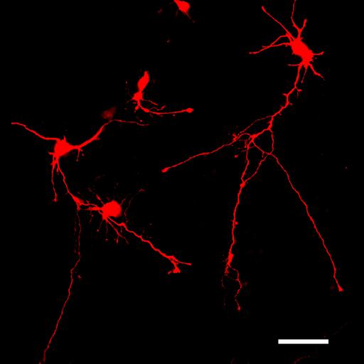  NCBI Organism:Mus musculus; Cell Types:CNS neuron (sensu Vertebrata) Cell Components:axon, dendrite; Biological process:neuron development, establishment of cell polarity;