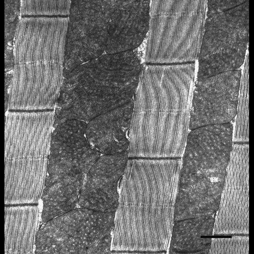  NCBI Organism:Drosophila melanogaster; Cell Types:flight muscle cell Cell Components:myofibril, mitochondrion, mitochondrial crista; Biological process:flight