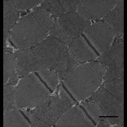  NCBI Organism:Drosophila melanogaster; Cell Types:flight muscle cell Cell Components:myofibril, mitochondrion, mitochondrial crista; Biological process:flight