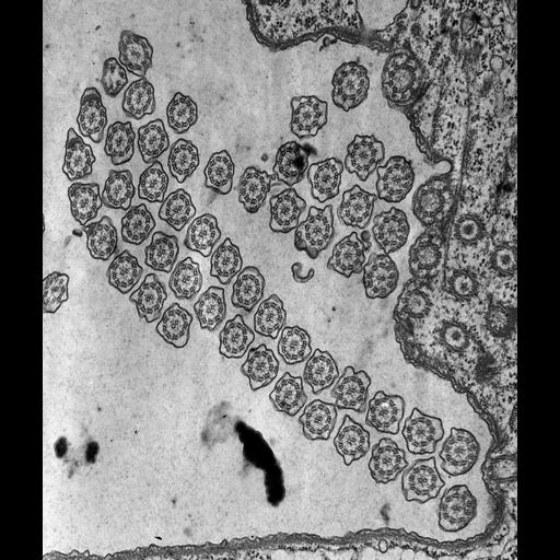  NCBI Organism:Tetrahymena pyriformis; Cell Types:cell by organism, eukaryotic cell, , ; Cell Components:axoneme, axonemal dynein complex, axonemal microtubule; Biological process:, cilium axoneme assembly;