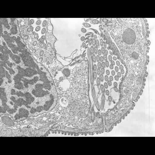  NCBI Organism:Opercularia [NCBITaxon:168247]; Cell Types:cell by organism, eukaryotic cell, , ; Cell Components:macronucleus, cell cortex, oral apparatus, cytoplasm, ; Biological process:oral apparatus organization, macronucleus organization, cytoplasm organization, cortical cytoskeleton organization;