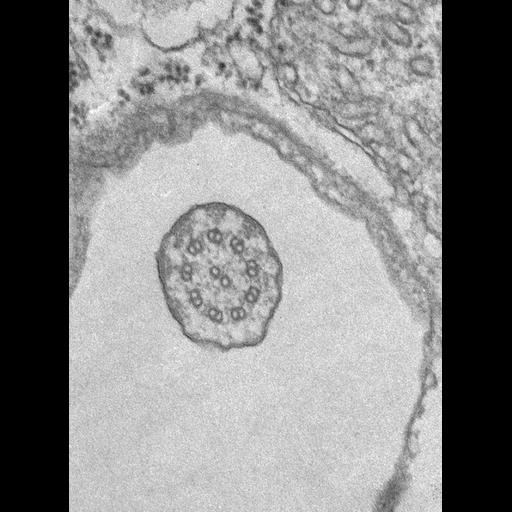  NCBI Organism:Tetrahymena pyriformis; Cell Types:cell by organism, eukaryotic cell, , ;