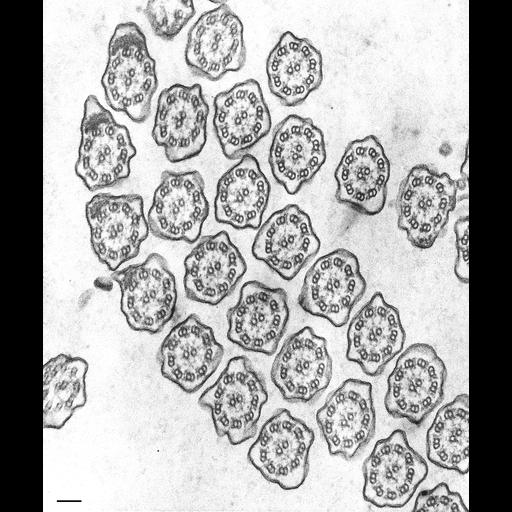  NCBI Organism:Tetrahymena pyriformis; Cell Types:cell by organism, eukaryotic cell, , ; Cell Components:cilium axoneme, axonemal dynein complex, axonemal microtubule, radial spoke; Biological process:cilium axoneme assembly