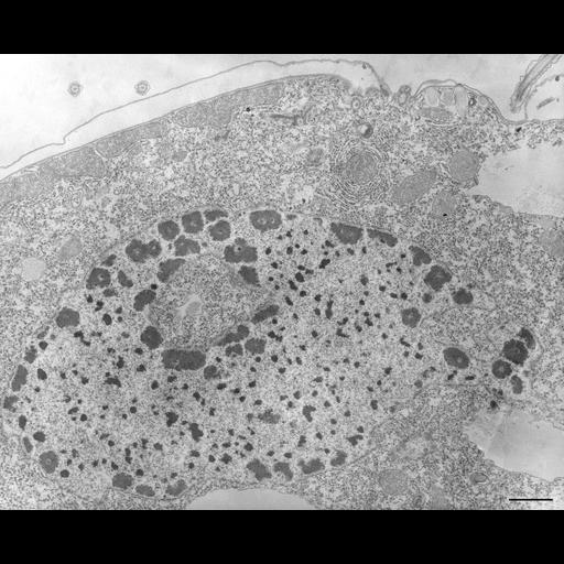  NCBI Organism:Tetrahymena pyriformis; Cell Types:cell by organism, eukaryotic cell, , ; Cell Components:macronucleus, nucleolus, nucleolus organizer region; Biological process:macronucleus organization, nucleolus organization;