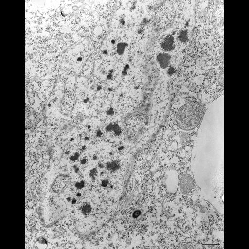  NCBI Organism:Tetrahymena pyriformis; Cell Types:cell by organism, eukaryotic cell, , ; Cell Components:macronucleus, nuclear pore, nuclear membrane; Biological process:macronucleus organization, nuclear membrane organization;