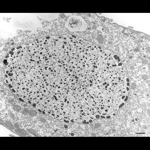  NCBI Organism:Tetrahymena pyriformis; Cell Types:cell by organism, eukaryotic cell, , ; Cell Components:macronucleus, nucleolus; Biological process:macronucleus organization, nucleolus organization;