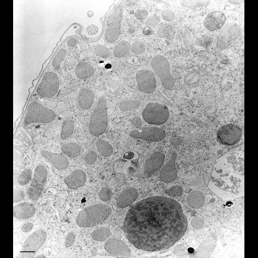  NCBI Organism:Tetrahymena pyriformis; Cell Types:cell by organism, eukaryotic cell, , ; Cell Components:micronucleus, autophagic vacuole, cytoplasm; Biological process:micronucleus organization, autophagy;