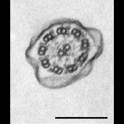  NCBI Organism:Tetrahymena pyriformis; Cell Types:cell by organism, eukaryotic cell, , ; Cell Components:cilium, cilium axoneme; Biological process:cilium axoneme assembly