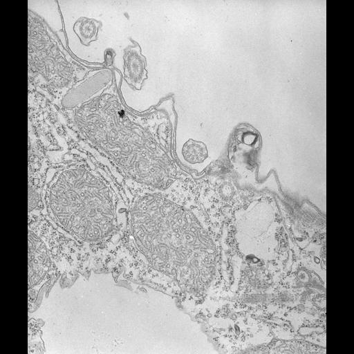  NCBI Organism:Tetrahymena pyriformis; Cell Types:cell by organism, eukaryotic cell, , ; Cell Components:cell cortex, ; Biological process:cortical granule exocytosis, ;