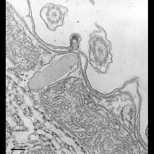  NCBI Organism:Tetrahymena pyriformis; Cell Types:cell by organism, eukaryotic cell, , ; Cell Components:cell cortex, cell cortex part, ; Biological process:cortical cytoskeleton organization