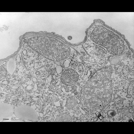  NCBI Organism:Tetrahymena pyriformis; Cell Types:cell by organism, eukaryotic cell, , ; Cell Components:cell cortex, cortical cytoskeleton; Biological process:microtubule cytoskeleton organization