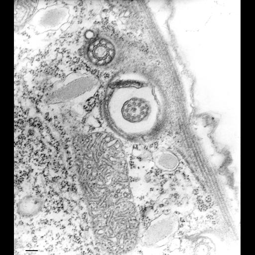  NCBI Organism:Tetrahymena pyriformis; Cell Types:cell by organism, eukaryotic cell, , ; Cell Components:cell cortex, cortical cytoskeleton, cortical microtubule cytoskeleton, mitochondrion, coated pit; Biological process:microtubule cytoskeleton organization