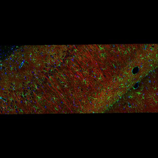  NCBI Organism:Rattus; Cell Types:multipolar neuron, glial cell; Cell Components:dendrite, nucleus, microtubule, intermediate filament cytoskeleton; Biological process:cell communication by chemical coupling