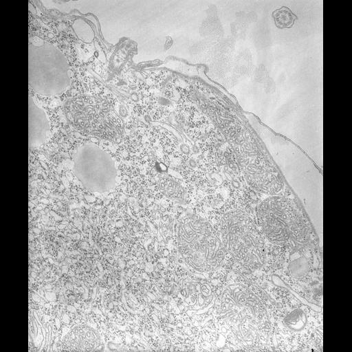  NCBI Organism:Tetrahymena pyriformis; Cell Types:cell by organism, eukaryotic cell, , ; Cell Components:cell cortex, coated pit, plasma membrane, clathrin coat of coated pit;