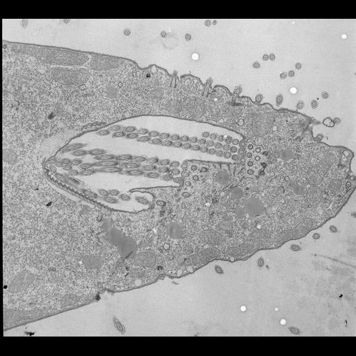  NCBI Organism:Tetrahymena pyriformis; Cell Types:cell by organism, eukaryotic cell, , ; Cell Components:oral apparatus, cilium; Biological process:oral apparatus organization, cilium movement, ;