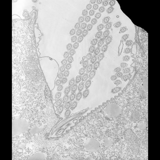  NCBI Organism:Tetrahymena pyriformis; Cell Types:cell by organism, eukaryotic cell, , ; Cell Components:, cilium axoneme, microtubule, plasma membrane; Biological process:oral apparatus organization, cilium axoneme assembly, plasma membrane organization;