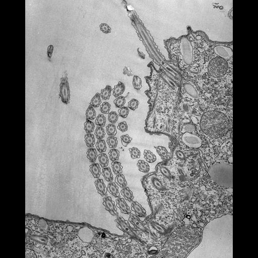  NCBI Organism:Tetrahymena pyriformis; Cell Types:cell by organism, eukaryotic cell, , ; Cell Components:oral apparatus, axonemal microtubule, microtubule basal body, cortical microtubule; Biological process:oral apparatus organization, microtubule basal body organization, ;