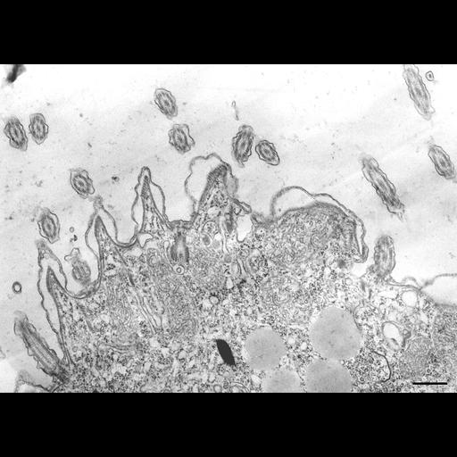  NCBI Organism:Tetrahymena pyriformis; Cell Types:cell by organism, eukaryotic cell, , ; Cell Components:cell cortex, coated pit, plasma membrane; Biological process:cargo loading into COPII-coated vesicle, cortical cytoskeleton organization, clathrin coat assembly;