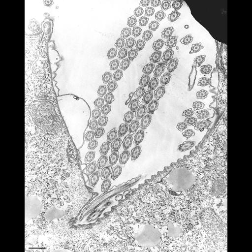  NCBI Organism:Tetrahymena pyriformis; Cell Types:cell by organism, eukaryotic cell, , ; Cell Components:oral apparatus, cilium axoneme, microtubule, ; Biological process:oral apparatus organization, cilium axoneme assembly, plasma membrane organization;