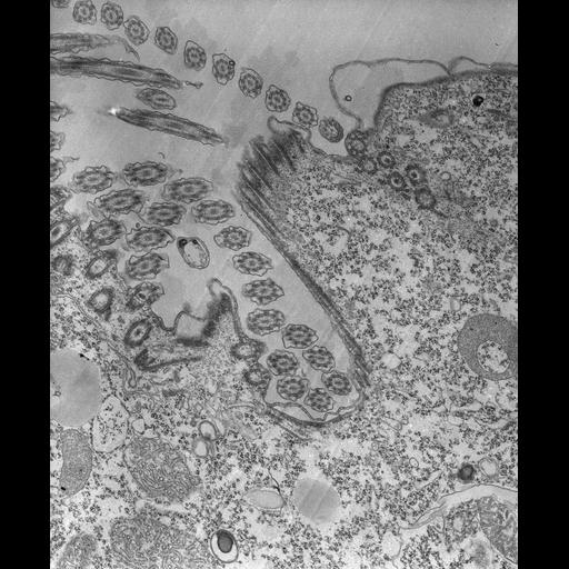  NCBI Organism:Tetrahymena pyriformis; Cell Types:cell by organism, eukaryotic cell, , ; Cell Components:oral apparatus Biological process:oral apparatus organization