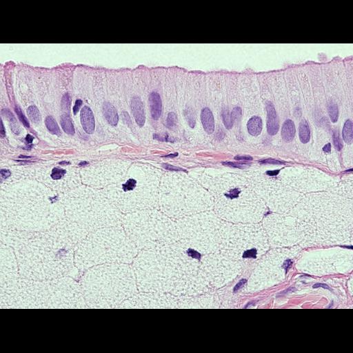  NCBI Organism:Homo sapiens; Cell Types:epithelial cell, foam cell; Cell Components:nucleus Biological process:leukocyte chemotaxis involved in inflammatory response, acute inflammatory response;