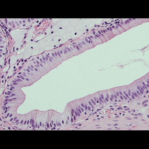  NCBI Organism:Homo sapiens; Cell Types:epithelial cell, foam cell; Cell Components:nucleus Biological process:leukocyte chemotaxis involved in inflammatory response, acute inflammatory response;