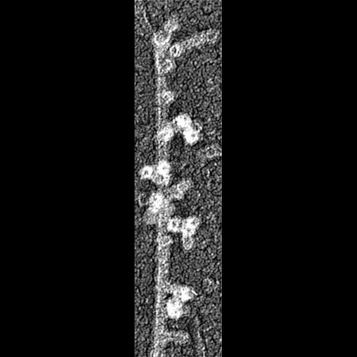  Cell Components:actin cytoskeleton Biological process:, ;