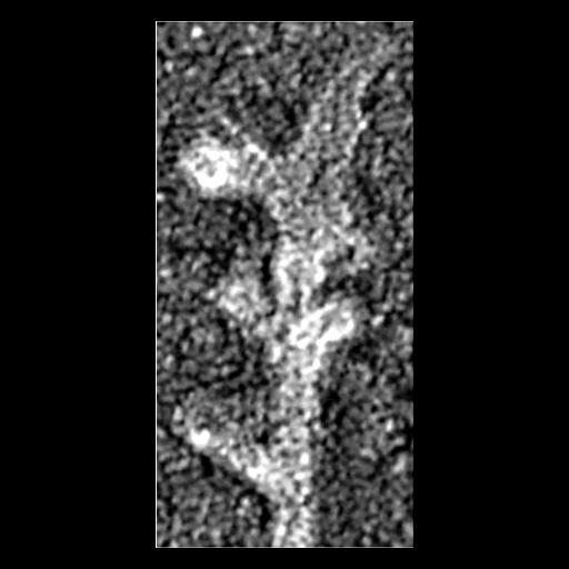  Cell Components:actin cytoskeleton Biological process:, , actin filament organization;