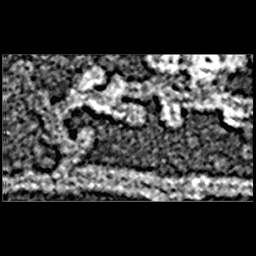  Cell Components:actin cytoskeleton Biological process:, , actin filament organization;