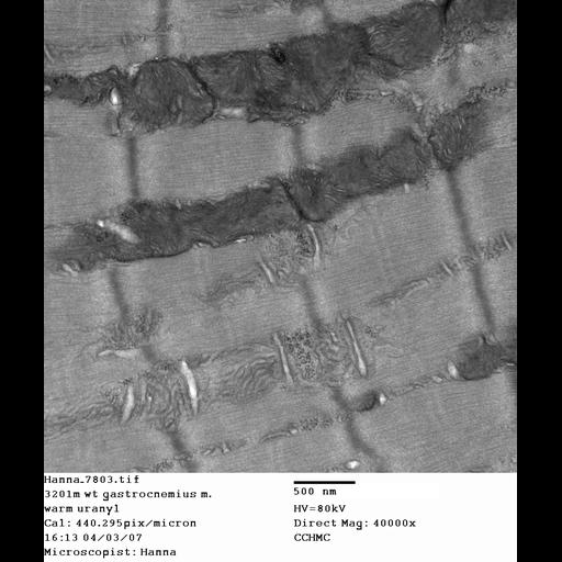  NCBI Organism:Mus musculus; Cell Types:skeletal muscle cell Cell Components:dystroglycan complex Biological process:plasma membrane organization