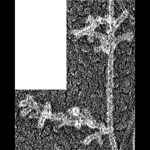  Cell Components:actin cytoskeleton Biological process:, ;