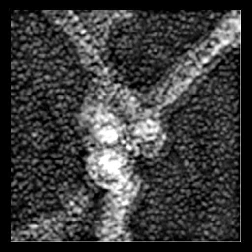  Cell Components:actin cytoskeleton, Arp2/3 protein complex; Biological process:, ;