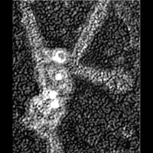  Cell Components:actin cytoskeleton, Arp2/3 protein complex; Biological process:, ;