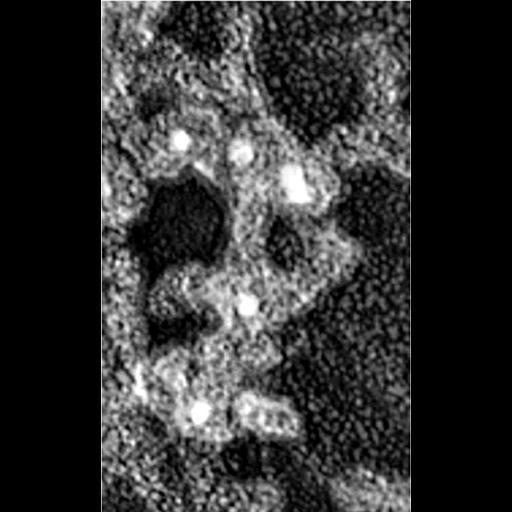  Cell Components:actin cytoskeleton, Arp2/3 protein complex; Biological process:, ;