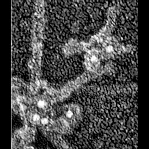  Cell Components:actin cytoskeleton, Arp2/3 protein complex; Biological process:, ;