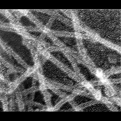  NCBI Organism:Xenopus laevis; Cell Types:fibroblast Cell Components:actin cytoskeleton, Arp2/3 protein complex, ; Biological process:, ;