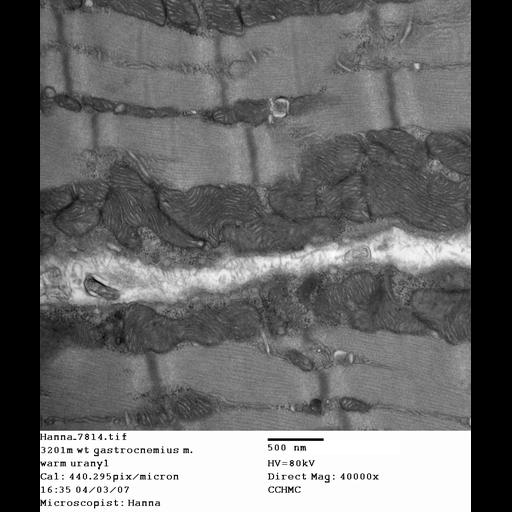  NCBI Organism:Mus musculus; Cell Types:skeletal muscle cell Cell Components:dystroglycan complex Biological process:plasma membrane organization