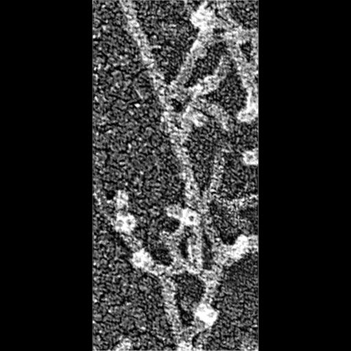  Cell Components:actin cytoskeleton