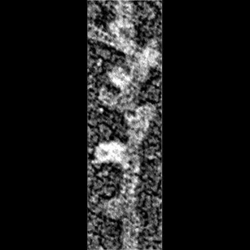  Cell Components:actin cytoskeleton