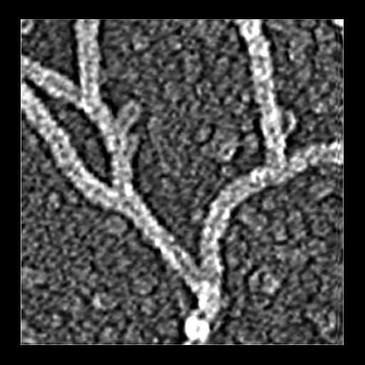  Cell Components:actin cytoskeleton Biological process:, actin filament-based process;