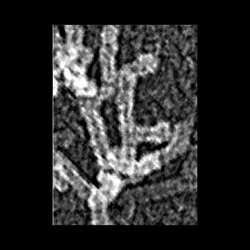  Cell Components:actin cytoskeleton