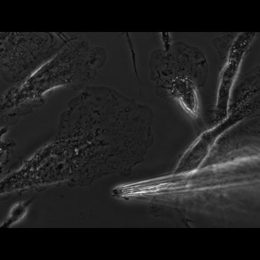  NCBI Organism:Mus musculus; Cell Types:macrophage Cell Components:ruffle membrane Biological process:ruffle organization