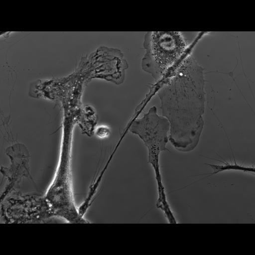  NCBI Organism:Mus musculus; Cell Types:macrophage Cell Components:ruffle membrane Biological process:cell motility