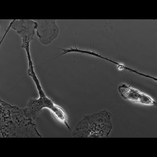  NCBI Organism:Mus musculus; Cell Types:macrophage Cell Components:ruffle membrane Biological process:cell motility