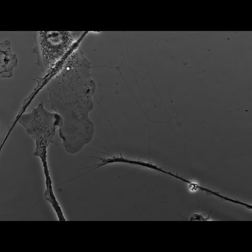  NCBI Organism:Mus musculus; Cell Types:macrophage Cell Components:ruffle membrane Biological process:cell motility