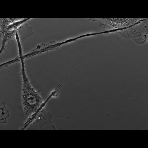  NCBI Organism:Mus musculus; Cell Types:macrophage Cell Components:ruffle membrane Biological process:cell motility