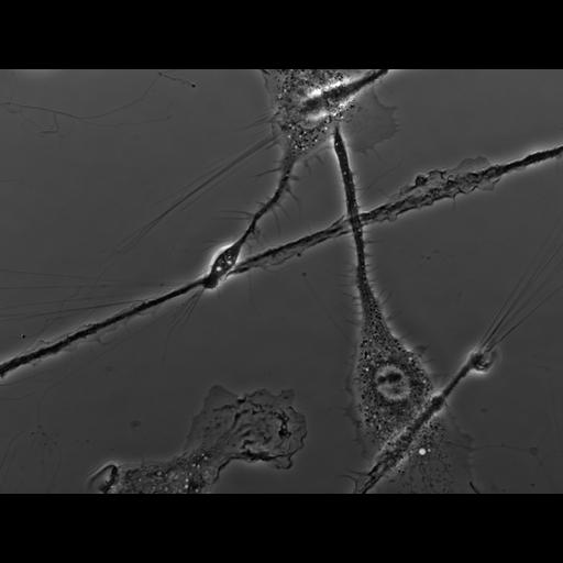  NCBI Organism:Mus musculus; Cell Types:macrophage Cell Components:ruffle membrane Biological process:cell motility