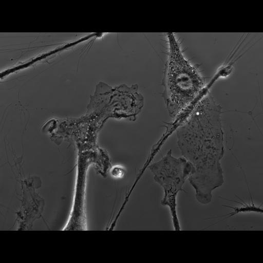  NCBI Organism:Mus musculus; Cell Types:macrophage Cell Components:ruffle membrane Biological process:cell motility