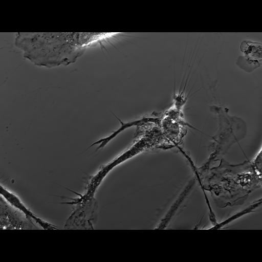  NCBI Organism:Mus musculus; Cell Types:macrophage Cell Components:ruffle membrane Biological process:cell motility