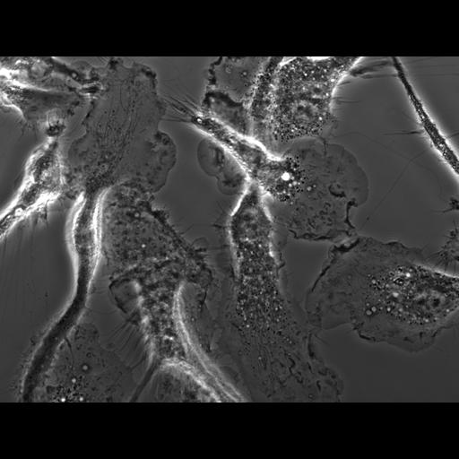  NCBI Organism:Mus musculus; Cell Types:macrophage Cell Components:ruffle membrane Biological process:cell motility